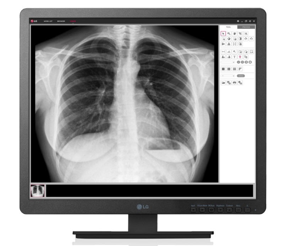 LG Clinical ReviewMonitor 19HK312C